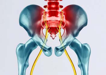 sciatica treatment rajendra nagar